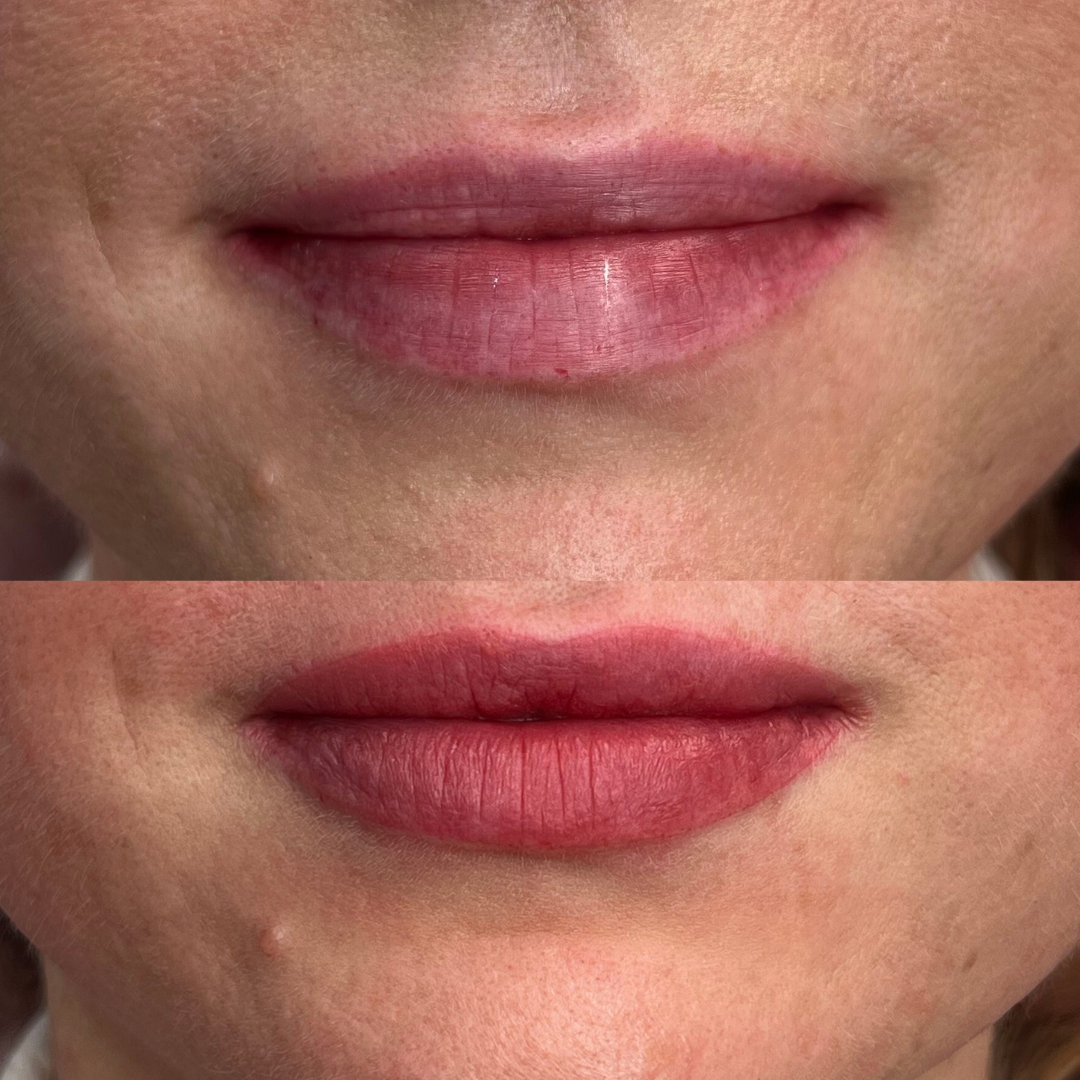 lip blush before and after