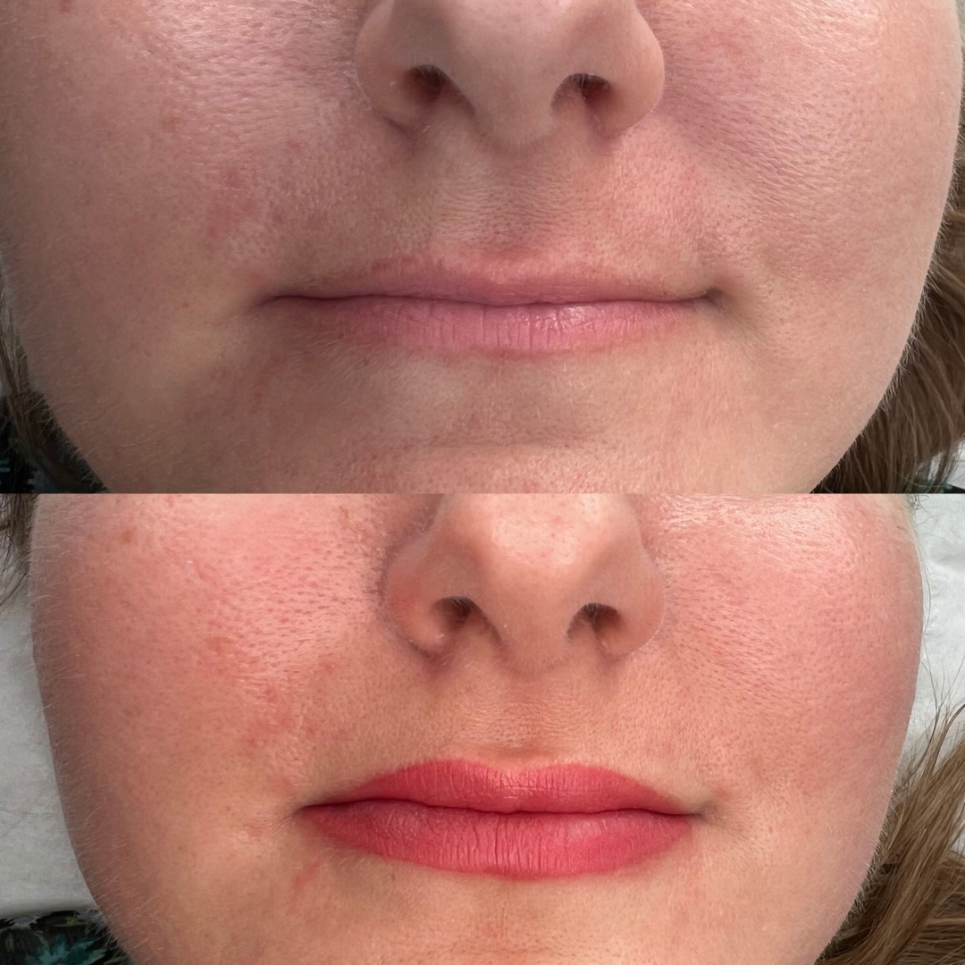Before and after of lip blush for thin lips Before and after lip blush