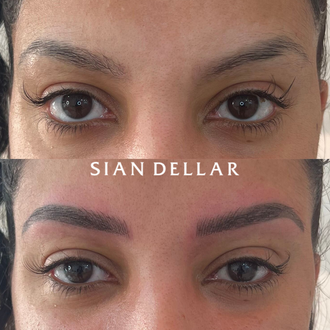 Combination brows before and after Achieve perfect symmetry of brows through combination brows